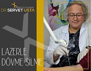 Ankara Lazerle Dövme Silme