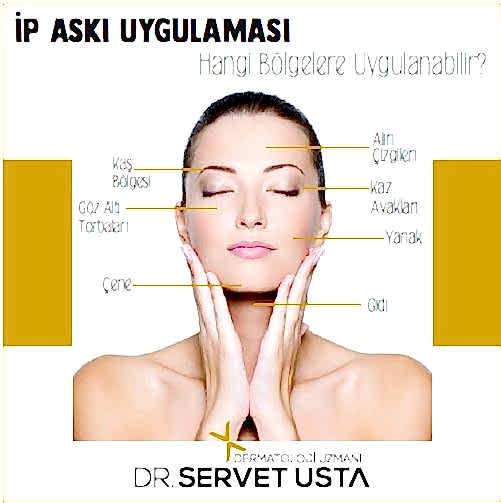Ameliyatsız Yüz Germe Ankara