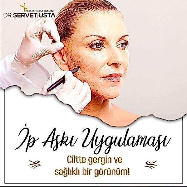 Ankara İp Askı Uygulaması ile Kaş Kaldırma