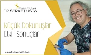 Ankara Kaş Arası Botoks Uygulaması