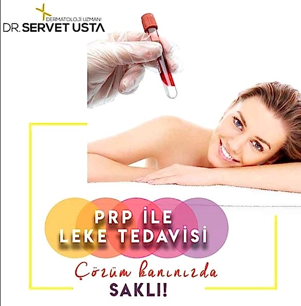 Ankara Leke Tedavisi