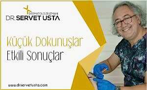 Ankara Migren Botoksu