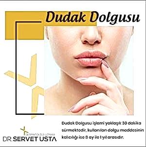 Dudak Dolgusu Ankara