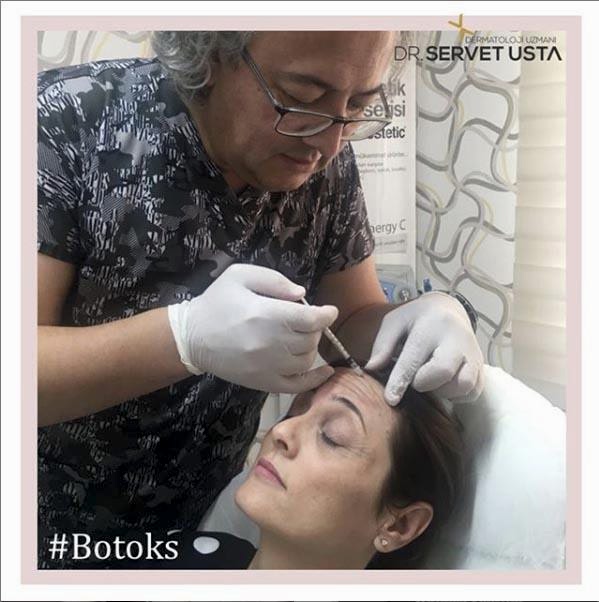 Ankara Botoks Uygulama
