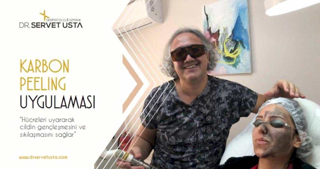 Karbon Peeling Ankara Çukurambar