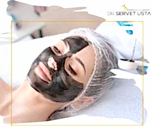 Ankara Kimyasal Peeling Uygulaması