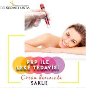 PRP Uygulama Merkezi Ankara